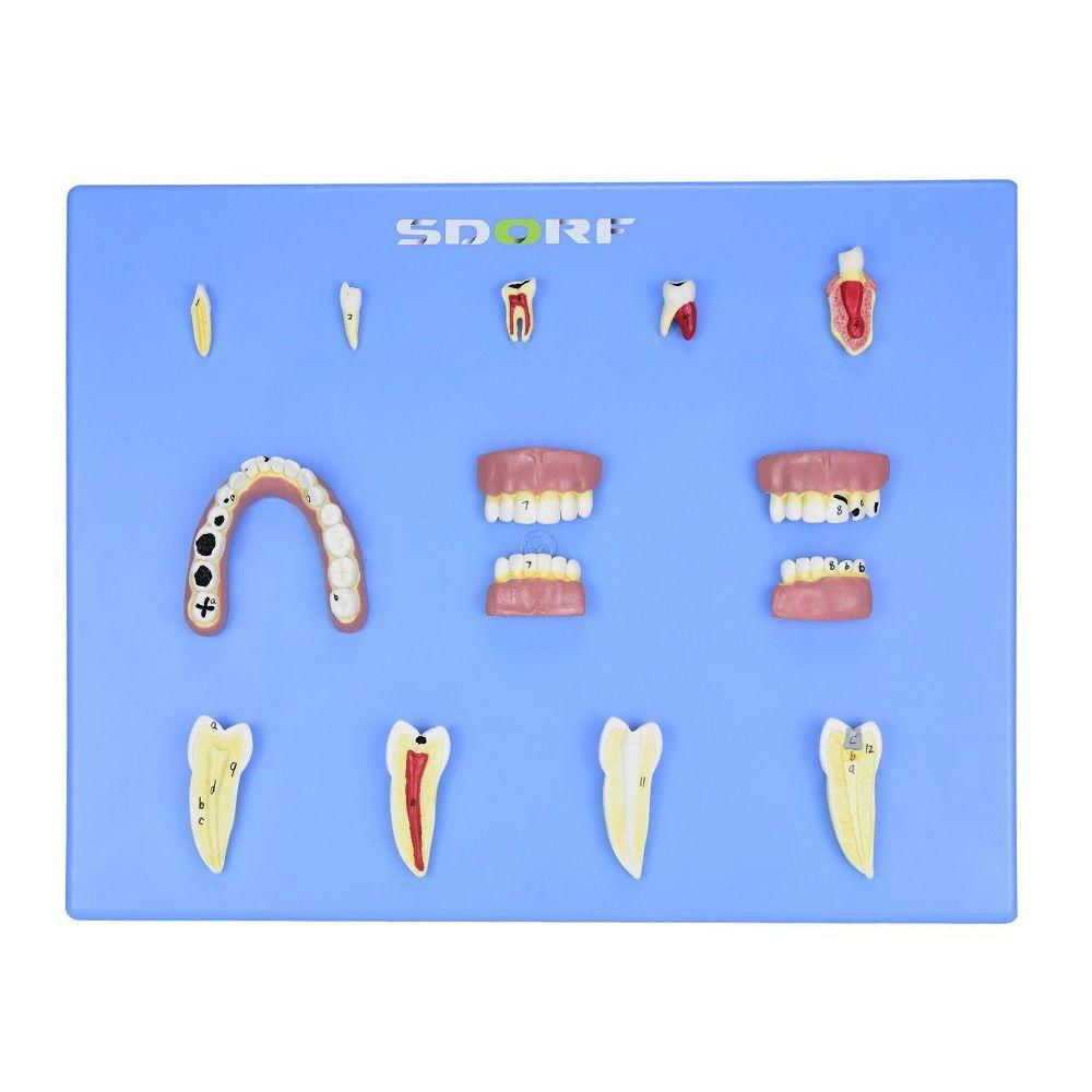 Modelo de Patologias Dentárias em 12 Partes em Placa